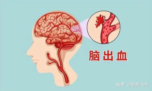 高血压的危害你注意了吗？